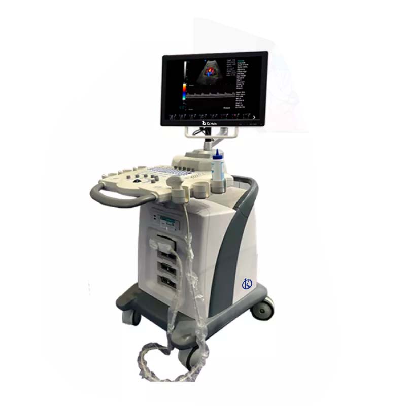 The Advantages of the Ultrasonic Color Doppler Diagnostic System: A Comprehensive Overview
